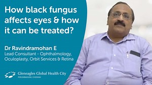 How black fungus affects eyes & how it can be treated? To know more about this, check out the video by Dr Ravindramohan E, Lead Consultant – Ophthalmology, Oculoplasty, Orbit services & Retina. #BlackFungus #Ophthalmology #Mucormycosis #eyes #Healthcare #OnYourSide #WeAreGleneaglesGlobalHealthCity | Gleneagles HealthCity Chennai