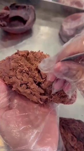 Cadaver-The First Teacher of Every Doctor🩺 #medicalstudents #anatomy #cadaver #ytshorts #trending