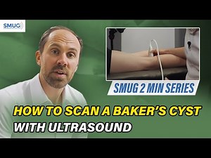 How to Scan a Baker’s Cyst with Ultrasound | MSK Knee Ultrasound Tutorial for Clinicians