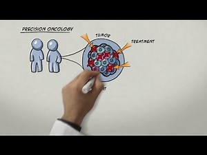 Chasing Metastatic Cancer Cells