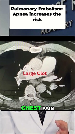 Doctor Reveals REAL Patient Case Sudden Shortness of Breath!