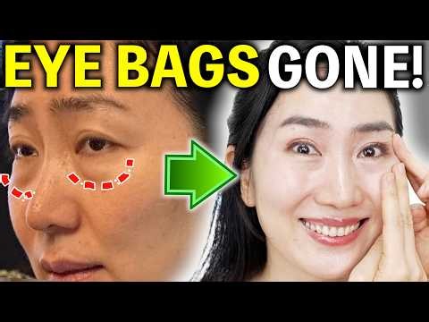 Tighten Puffy Under-Eye Bags & Fade Dark Circles — No Surgery Needed