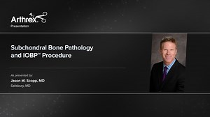 Subchondral Bone Pathology and IOBP™ Procedure