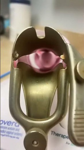 We can never forget the speculum….