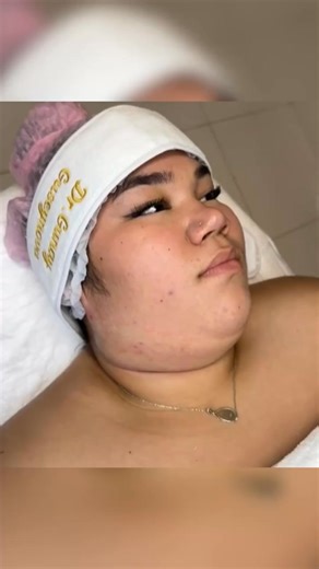 Learn About Double Chin Removal Approaches | Creative Searches