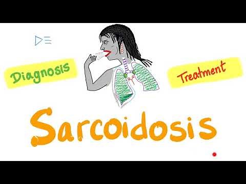 Sarcoidosis Diagnosis and Management | Restrictive Lung Disease | Pulmonology