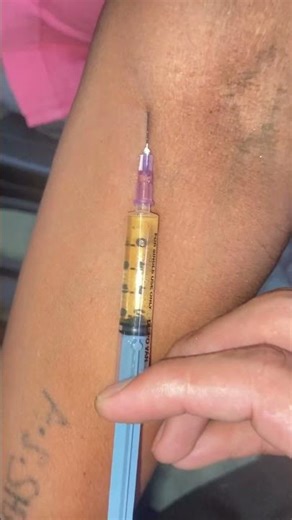 Iv injection #shorts