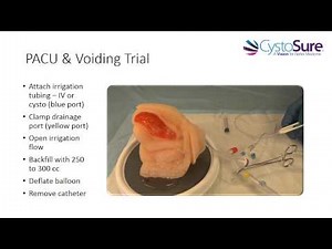 PACU Cystosure - Voiding Trial
