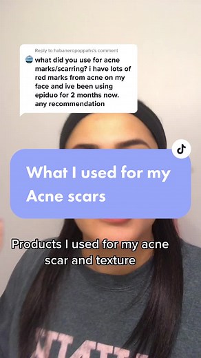 Transforming Acne Scars with Epiduo: What You Need to Know