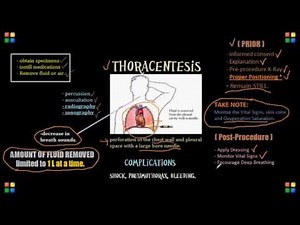 Thoracentesis NCLEX Review Important Content