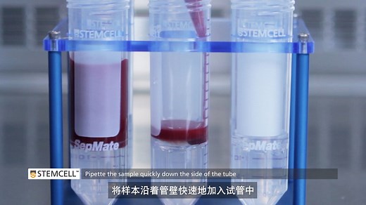 15分钟内从全血中分离出PBMCs