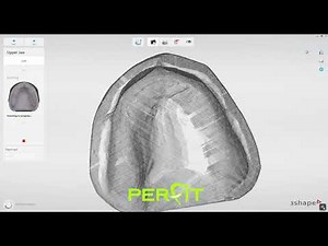 How to scan a wax-up with a 3Shape scanner