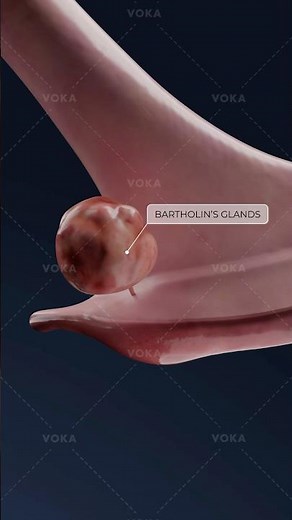 What is BARTHOLINITIS and how does it affect the vaginal area? Explore gynecology in 3D with VOKA