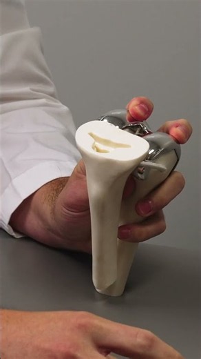What is a knee replacement? | Ohio State Medical Center