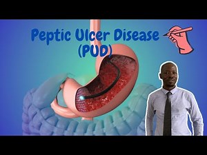 Understanding Peptic Ulcer Disease | Causes, Symptoms, Diagnosis & Treatment