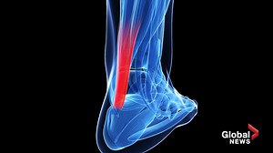 What is an Achilles injury?