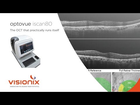 Optovue iScan80 - EN