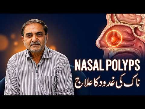 How to Treat Nasal Polyps Without Surgery? - Nak ki Gadood ka Ilaj - Nasal Polyps vs Sinusitis