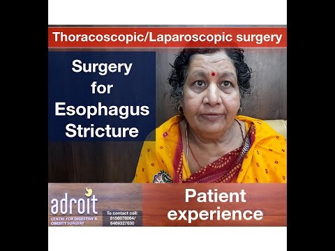 Surgery for esophagus stricture (Blockage of food pipe): Patient experience