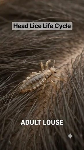 Have you ever wondered how head lice begin and grow? 🪳👀#HeadLice #LiceLifeCycle #LifeCycle