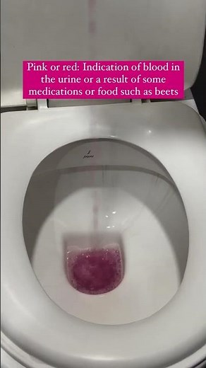 What Your Pee Color Says About Your Health | Decode the Signs with Pee Safe