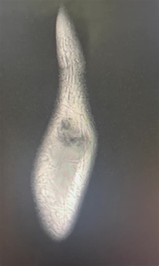 Thumb MRI: Understanding Anatomy for Better Diagnosis | Kareem Qatouni posted on the topic | LinkedIn