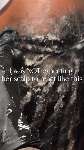 Book Your Loc Detox Appointment in Smyrna, GA