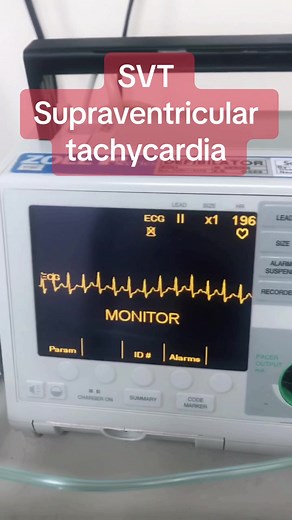 Dr Ashraf Elfeky على TikTok