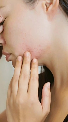 Discover the Amazing Benefits of Vitex Seeds