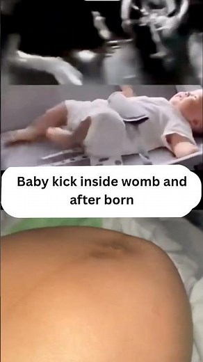 Baby moving in Belly😳 Baby kicking
