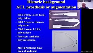 The History of ACL Repair and Reconstruction and the Role of Cell Biology in Combination with Polymer Chemistry in the Future