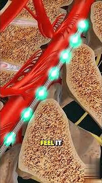 Spinal Cord Stimulator SCS Implantation Procedure 3D Animation