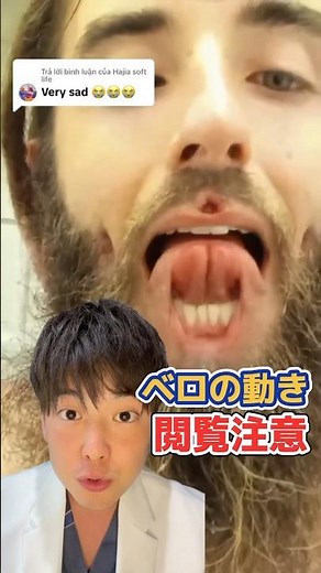 ベロの動きについて説明します #歯医者 #おすすめ #舌