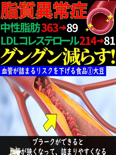 【薬の前に】劇的にLDLコレステロール・中性脂肪を下げる最高の食品8選 - P.2 #LDL #LDLコレステロール #中性脂肪 #コレステロール対策 #血液サラサラ #動脈硬化予防 #生活習慣病予防