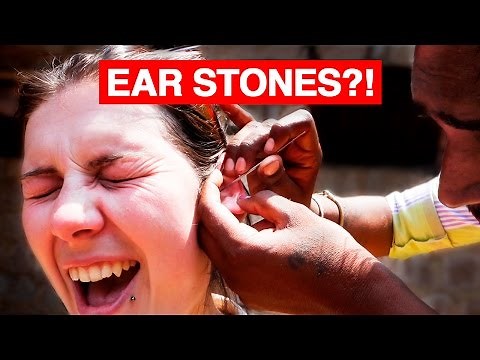 Indian Ear Cleaning | STONES?!