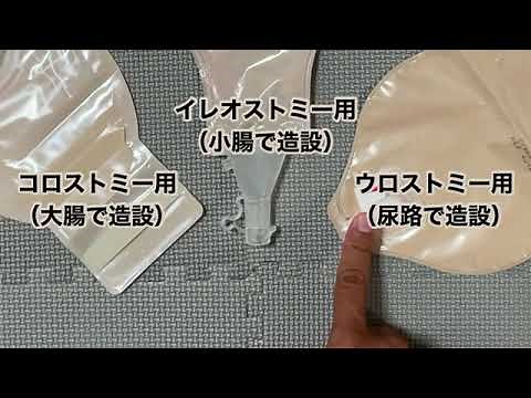 Types of outlets for stoma appliances