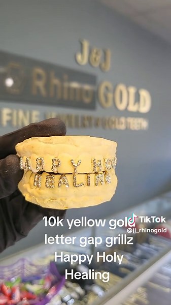 Same Day Gold Grillz in Lawrenceville, GA