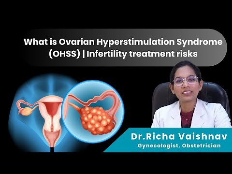 What is Ovarian Hyperstimulation Syndrome (OHSS) | Infertility treatment risks | Dr. Richa Vaishnav