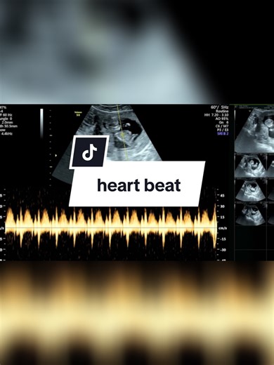 Hearing the Baby's Heartbeat