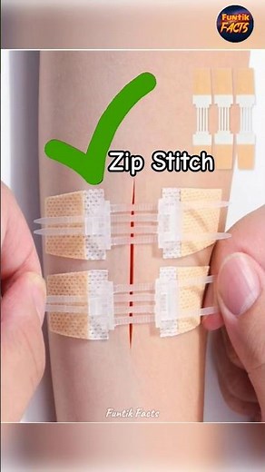 Zip Stitch | No More Painful Stitches
