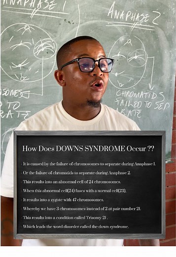 Understanding Down Syndrome Causes and Mechanisms
