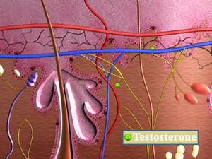 Acne (Understanding Disease_ Dermatology)