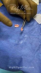 Let’s talk about deviated septum and why it makes you hard to breathe!