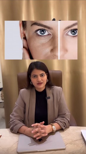 DrMadhurima Nayak Tripathi on Instagram: "✨ Chemical Peel Benefits ✨ Unveil your inner glow with chemical peel! 💆‍♀️ ✔ Removes tan & pigmentation ✔ Controls acne & oil ✔ Reduces fine lines & pores ✔ Brightens & smoothens skin ✔ Gives you that fresh, youthful radiance ✨ #ChemicalPeel #GlowingSkin #SkinRejuvenation #AestheticClinic #DrMadhurimaNayak #MNPolyclinic #SkinCare #HealthySkin #FacialGlow #Cosmetology #LucknowClinic #BeautyEnhancement #PeelPerfection"