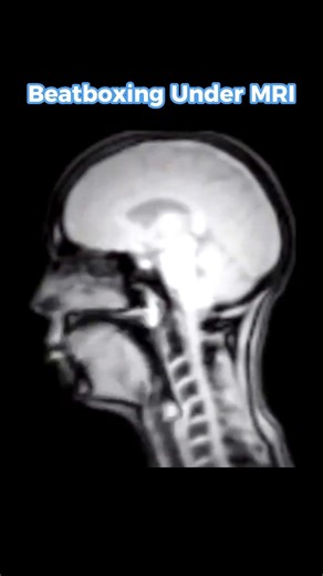 Beatboxer under MRI #shorts