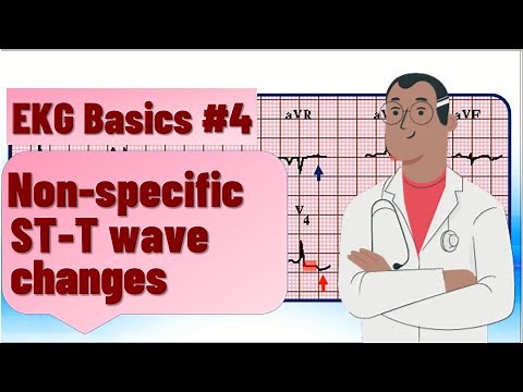 ECG basics | nonspecific ST T wave changes | differential diagnosis, ECG findings and examples