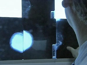 Nuclear medicine injections are often used in cancer screenings: What happens when it goes wrong?