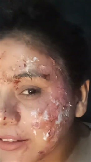 mini Make removal vlog