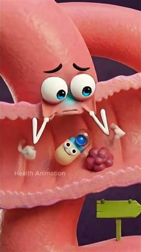 Capsule Endoscopy: How a Tiny Camera Detects Intestinal Problems ?