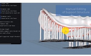 ModuleWorks Dental CAM - 增材组件